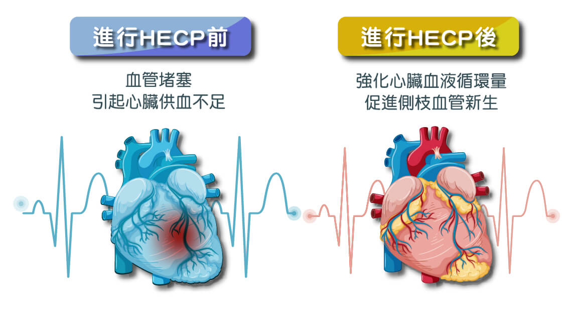 螺旋體外反搏保養的六大好處