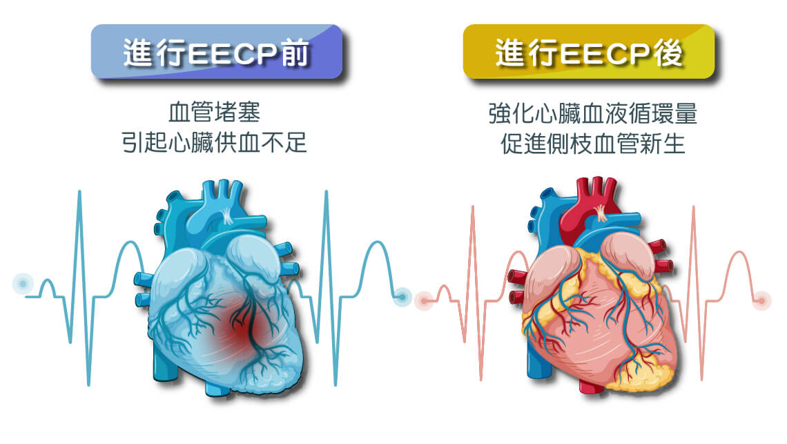 體外反搏保養的六大好處