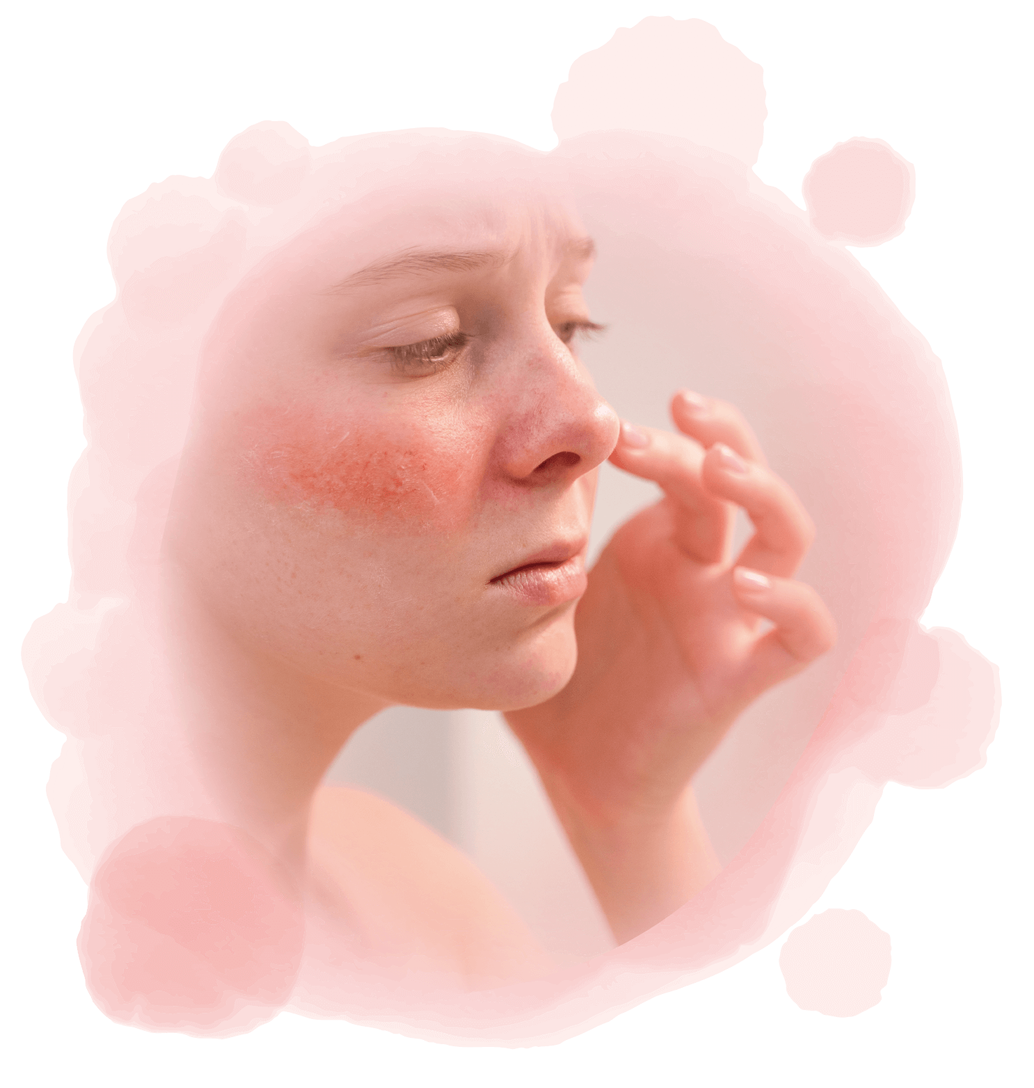 舒適美健康診所_皮膚敏感問題