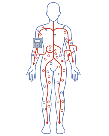 舒適美健康診所_血液淨化循環療程