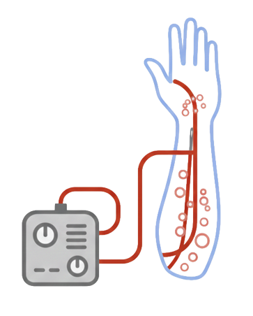 舒適美健康診所_氦氖雷射