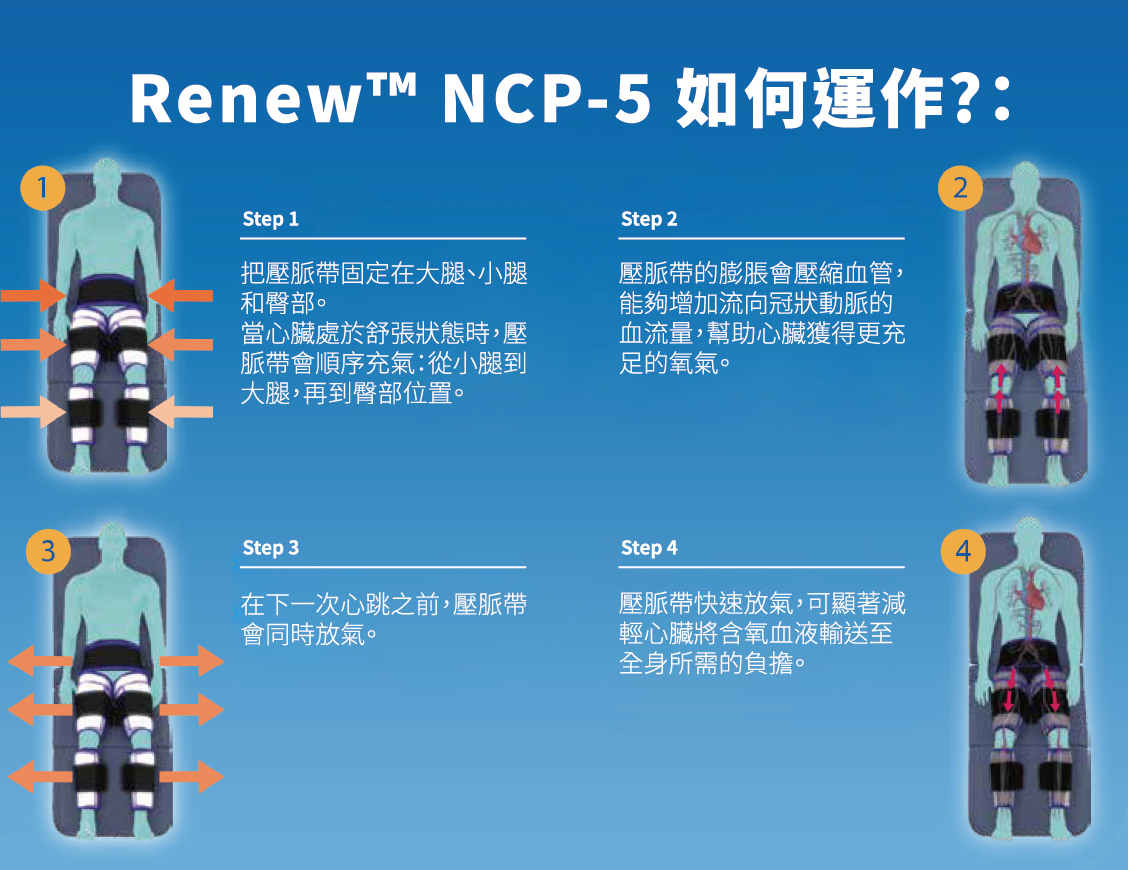 Renew ECP 系統操作示意圖