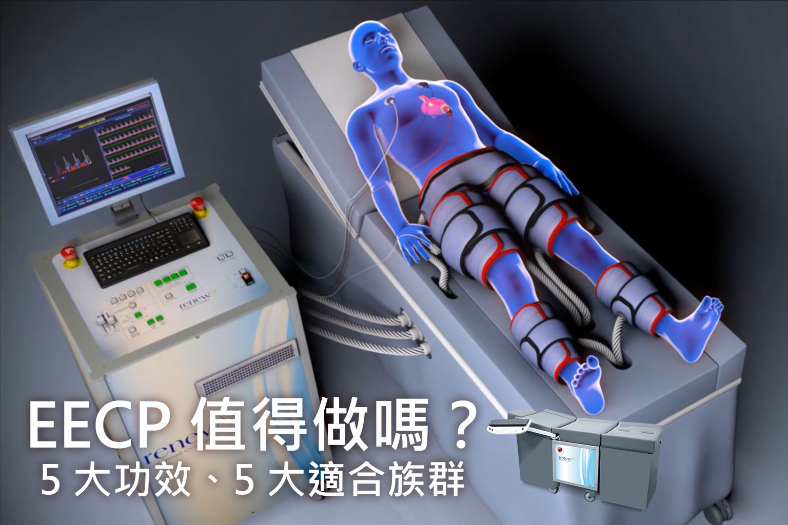 EECP 值得做嗎？EECP 5 大功效、5 大適合族群：重點分析