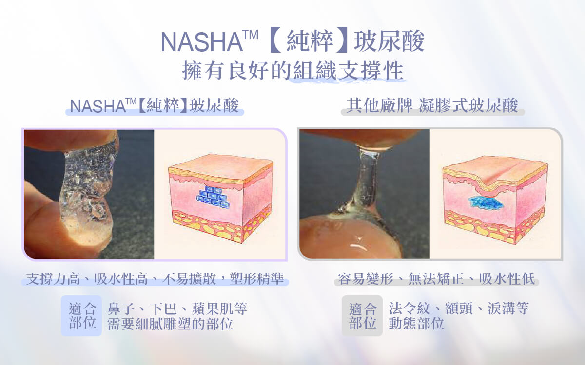 NASHA™ 純粹玻尿酸的特點